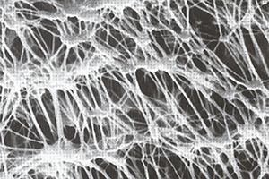 Membrane filter media image of PTPE