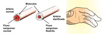 Vibração ocupacional